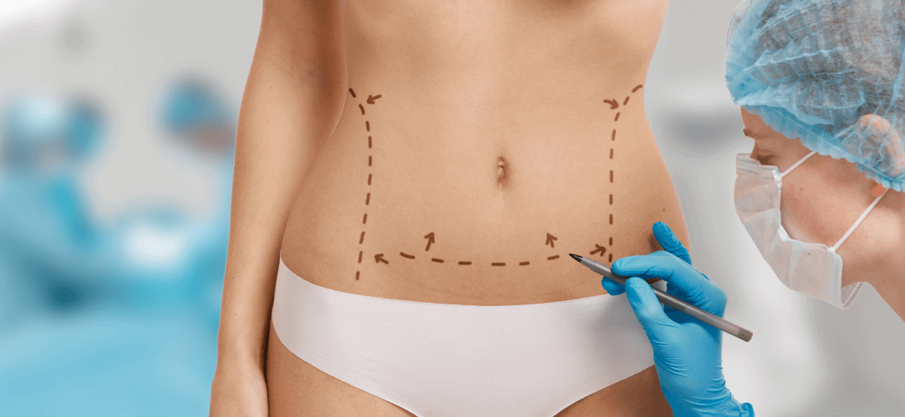 VASER Liposuction Overview