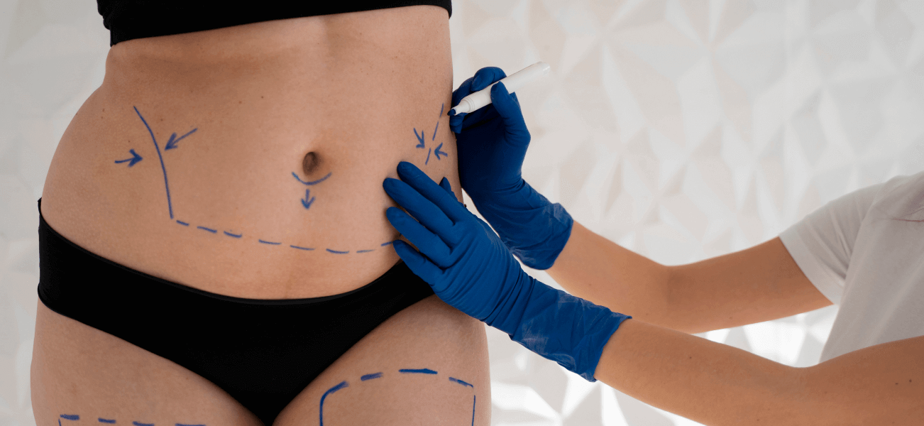 VASER Liposuction Cost