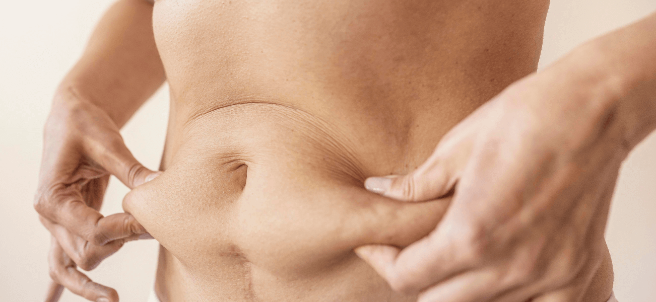 What is VASER liposuction